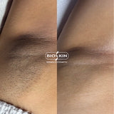 BSK204 CLEARING TONE – Intimate Whitening Pro Kit | Professional Skin Brightening | Price in Pakistan